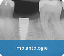 implantologie