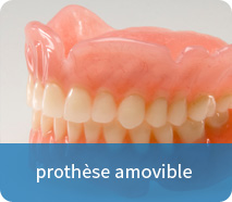 prothese amovible